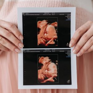 Cool-Ideas-On-When-To-Take-Maternity-Photos