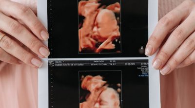 Cool-Ideas-On-When-To-Take-Maternity-Photos