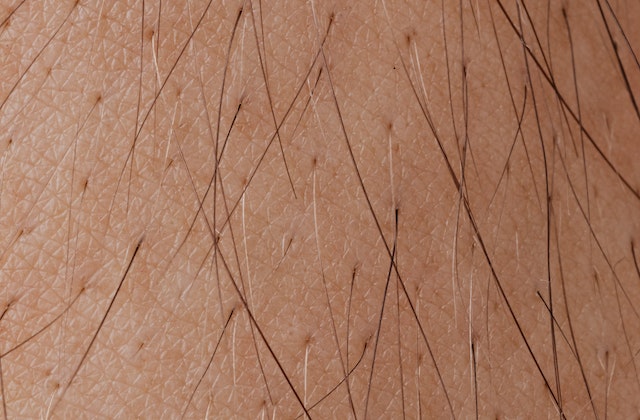 Herpes Vs Ingrown Hair – 8 Alarming Differences 1 pexels karolina grabowska 4046568